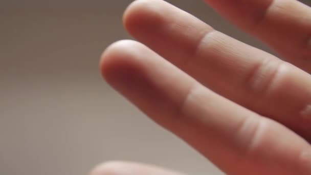 Dermatologische Erkrankungen auf der Hand — Stockvideo