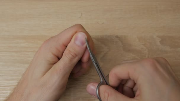 Man snijdt nagel close-up — Stockvideo