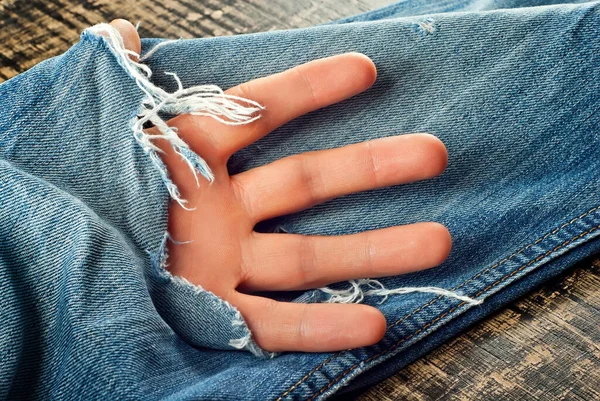 Blue torn jeans on a black background. Hole in the pants close up. The concept of worn clothes and poverty. The hand sticks out of the hole. The man\'s fingers are stuffed into a torn hole.
