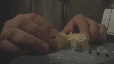 Yakın çekim teknisyeni diş protezini bankta birleştiriyor, eller iğne ve deneme köprüsünü yerleştiriyor, aletler ve lamba düzenleniyor.