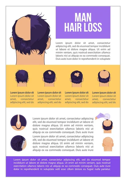 Homme perte de cheveux problème plat illustration Calvitie étapes — Image vectorielle