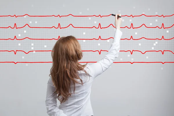 Doktor kvinna ritning elektrokardiogram — Stockfoto