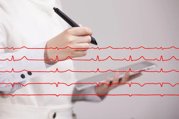 Doctor woman drawing cardiogram — Stock Photo, Image