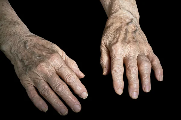 Senior two  hands — Stock Photo, Image