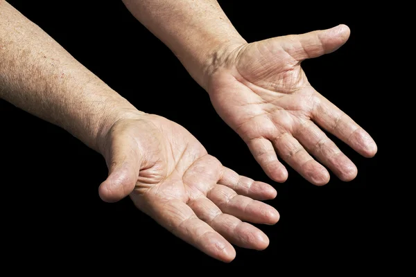 Two Senior hands — Stock Photo, Image