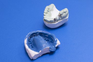 Dental prothetic clipart