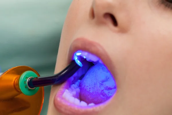 The Dental Operation — Stock Photo, Image