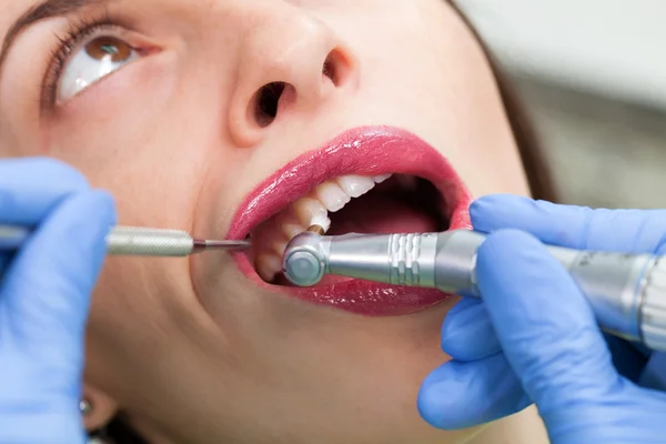 Close-up medical dentist procedure of teeth polish — Stock Photo, Image