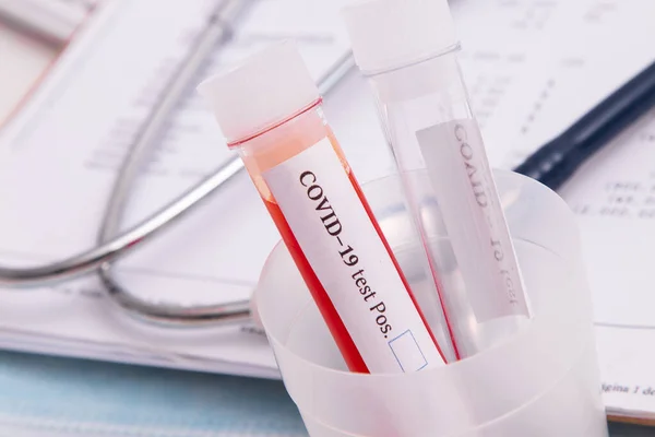 Coronavirus Infection Test Tubes Hospital — Stock Photo, Image