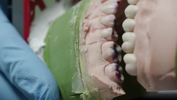 Plaster model in the hands of an orthodontist close up. Modem orthodontics — Stock Video