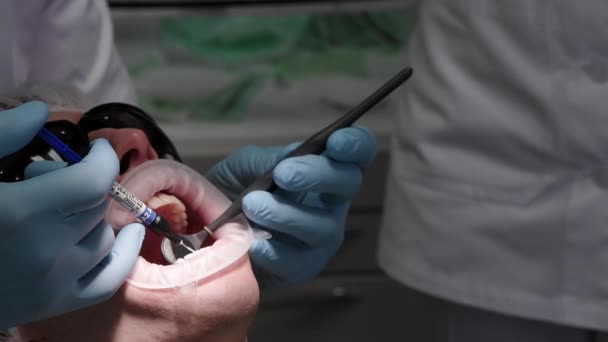 Processo di installazione dei sistemi di staffe. Paziente sulla sedia dentale. Ortodonzia moderna. Primo piano — Video Stock