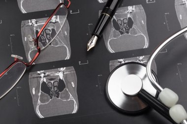 Dizi bir tomografi görüntüleri