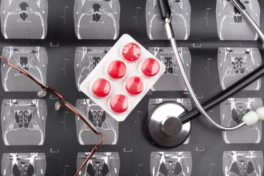 Dizi bir tomografi görüntüleri