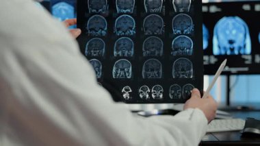 Doktor beyin MR taramalarını analiz ediyor ve modern klinikte birden fazla monitör duruyor, gelişmiş nörogörüntüleme teknolojisi ve sağlık teşhisi konsepti. Yüksek kalite 4k görüntü