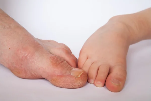 Female foot. Studio shot. — Stock Photo, Image