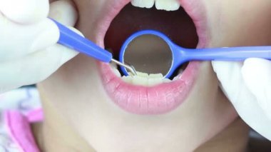 Diş hekiminin dişleri temizlemeve plak sökücü aletle kontrol etme yakın çekimi Hd Görüntüleri