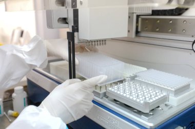 MINSK, BELARUS - 1 EKİM, 2020: Coronavirus 'a karşı aşı yapmak, koronavirüs testlerini kontrol etmek
