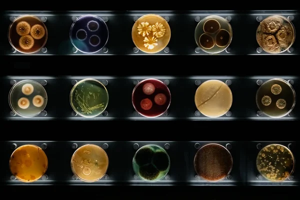 Различные Типы Бактерий Плесени Грибки Чашках Петри — стоковое фото