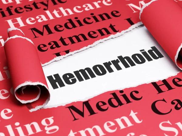 Conceito de saúde: texto preto Hemorróide sob o pedaço de papel rasgado — Fotografia de Stock