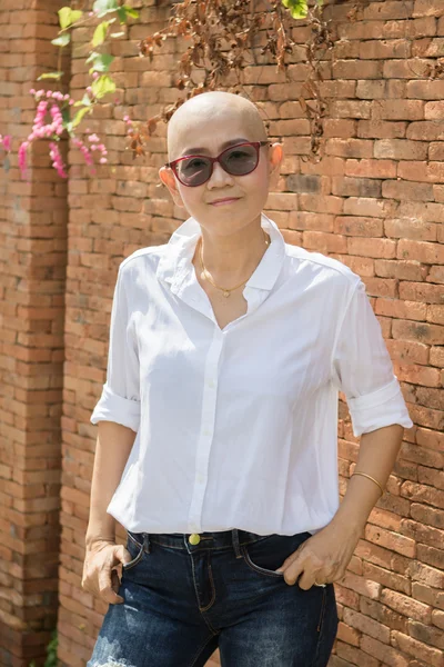 Портрет уверенность в себе азиатская женщина с лысой головой после рака — стоковое фото