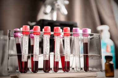 Coronavirus 'un Covid-19 etiketli bir tüp örneğiyle mikrobiyolog Covid-19' un analiz ve örnekleme laboratuarında doktor.