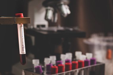 Yeni hızla yayılan Coronavirus 'un kan testi sonucu Çin' in Wuhan şehrinden geliyor.