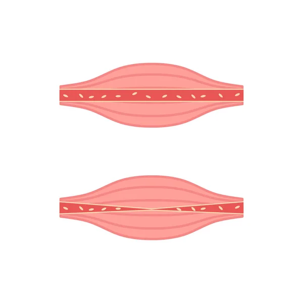 Ensemble Icônes Musculaires Malsaines Saines Anatomie Médicale Symbole Flux Sanguin — Image vectorielle