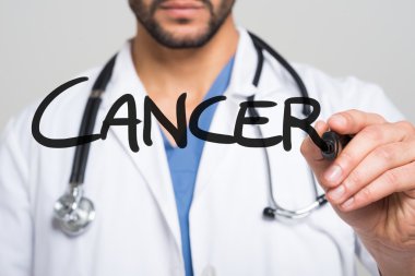 Kanser sözcüğü yazmaya doktor