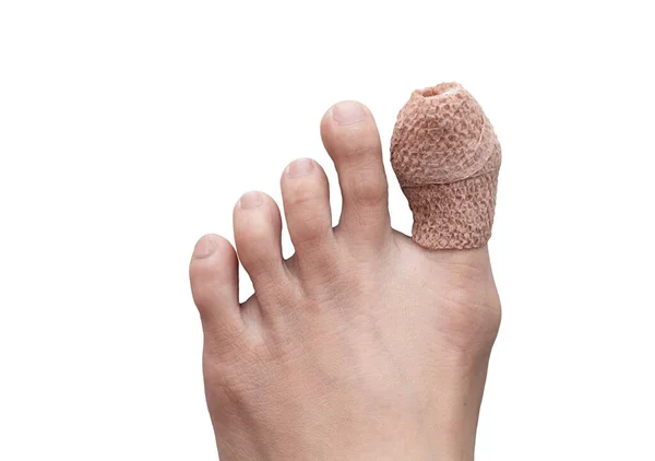 Крупным Планом Женщины Правой Ноги Раненым Большом Пальце Ноги Изолированный Стоковая Картинка