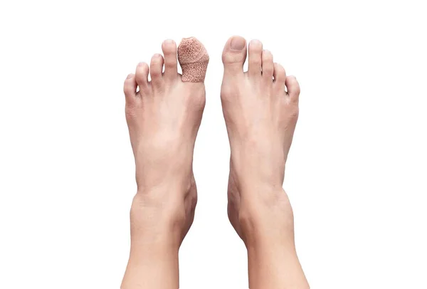 Вид Сверху Две Голые Человеческие Женские Ноги Раненым Большим Пальцем — стоковое фото