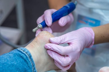 Pedikür uzmanı topuk bakımını yapar.