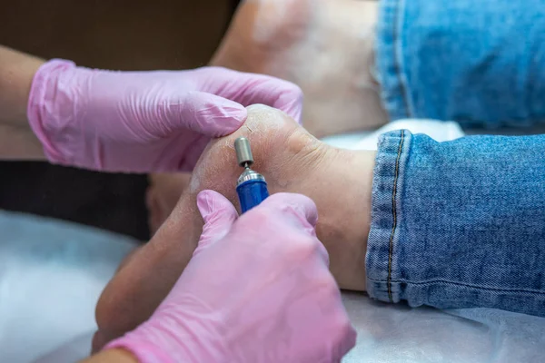 Pedikür uzmanı topuk bakımını yapar.