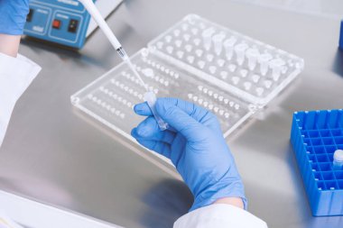 Laboratuvarda kan örneğiyle çalışan bilim adamı. Yeni hızla yayılan Corona virüsü salgınının kan testi sonucu..