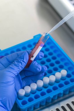 Laboratuvarda kan örneğiyle çalışan bilim adamı. Yeni hızla yayılan Corona virüsü salgınının kan testi sonucu..