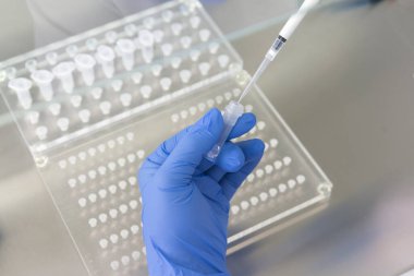Laboratuvarda kan örneğiyle çalışan bilim adamı. Yeni hızla yayılan Corona virüsü salgınının kan testi sonucu..