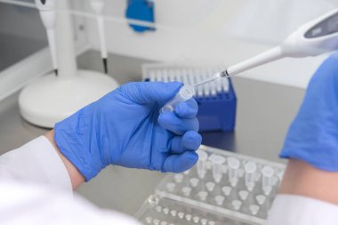 Laboratuvarda kan örneğiyle çalışan bilim adamı. Yeni hızla yayılan Corona virüsü salgınının kan testi sonucu..