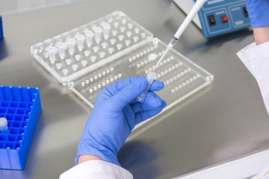 Araştırma laboratuvarında kan tüpü testi yapan doktor. Corona virüsü salgını aşısı geliştirme konsepti.