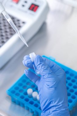 Laboratuvarda kan örneğiyle çalışan bilim adamı. Yeni hızla yayılan Corona virüsü salgınının kan testi sonucu..