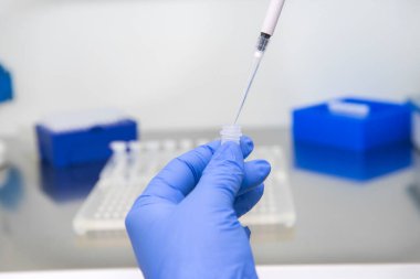 Araştırma laboratuvarında kan tüpü testi yapan doktor. Corona virüsü salgını aşısı geliştirme konsepti.