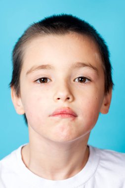 Mavi arka planda hafif perioral deri iltihabı olan üzgün bir çocuğun portresi.