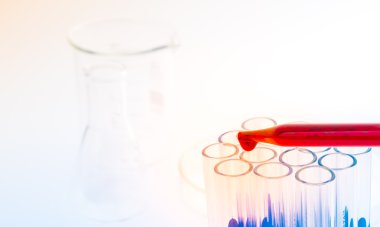 laboratuvar test tüpleri, tıbbi Züccaciye Mağazaları. (Filtre uygulanmış resim prosedürü