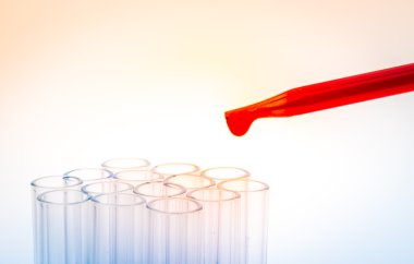 laboratuvar test tüpleri, tıbbi Züccaciye Mağazaları. (Filtre uygulanmış resim prosedürü
