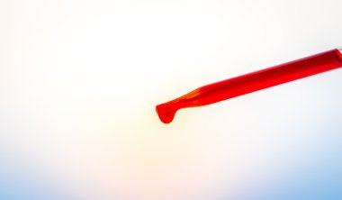 laboratuvar test tüpleri, tıbbi Züccaciye Mağazaları. (Filtre uygulanmış resim prosedürü