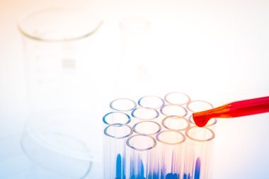 laboratuvar test tüpleri, tıbbi Züccaciye Mağazaları. (Filtre uygulanmış resim prosedürü