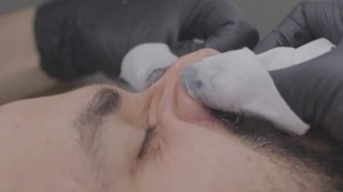 Yüzün cildindeki gözenekleri temizleme işlemine yakın çekim