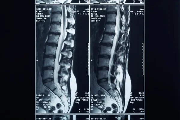 Рентгенография позвоночника — стоковое фото