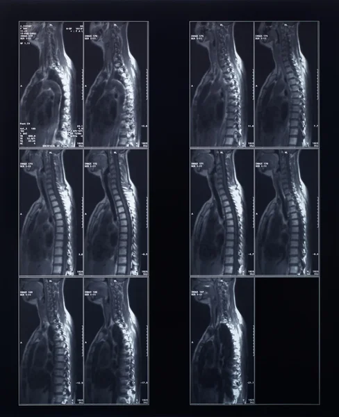 X-ray spine and neck radiography — Stock Photo, Image