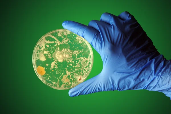 Gloved hand holding bacteria growing in a petri dish — Stock Photo, Image