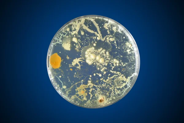 Bacteriën groeien in een petrischaal — Stockfoto