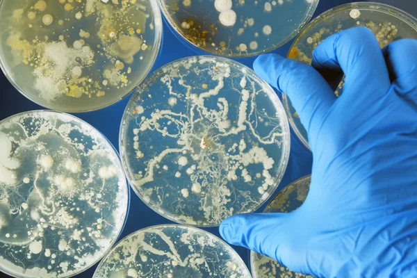 Gloved hand holding bacteria growing in a petri dishes — Stock Photo, Image